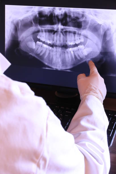 Best Emergency Root Canal Treatment in Ackley, IA